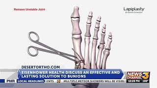 Eisenhower Health talks about a solution to bunions