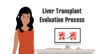 Liver Transplantation | The Evaluation Process