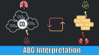 CO2 Retention (PaCO2): ABG analysis