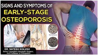 Osteoporosis Causes, Symptoms, Treatment & Prevention | Dr Natesh Kolusu | Socialpost Healthcare