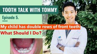 What Should Parents Do If the Child's New Front Teeth Are Coming in Behind Their Baby Teeth?