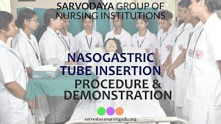 NASOGASTRIC TUBE | DEMONSTRATION | SARVODAYA COLLEGE OF NURSING |