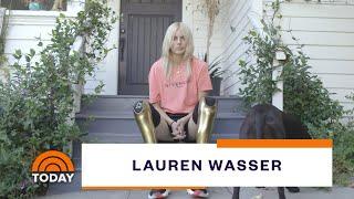 Model Who Lost Legs To Toxic Shock Syndrome Shares Inspiring Mission | TODAY