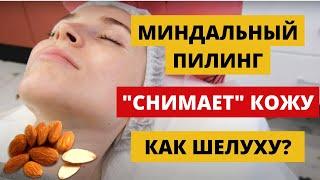 Что такое миндальный пилинг для лица