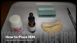 How to Mix/Place IRM (Intermediate Restorative Material)
