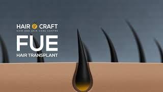 Hair O Craft - The Hair Transplant Experts