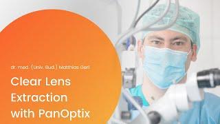 Clear Lens Extraction (CLE) with AcrySof IQ PanOptix lens implantation