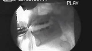 harmonica x-ray video