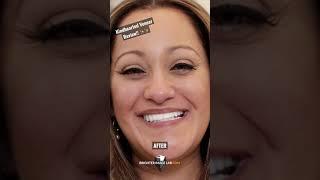 A Life Changing New Smile with BilVeneers - Real Client Testimonial