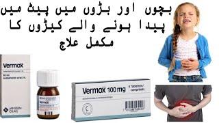 how to use Vermox tablet uses | Vermox syrup uses in urdu |Treatment of intestinal worms in children