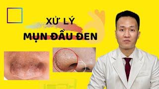 MỤN ẨN - MỤN ĐẦU ĐEN Cách phân biệt - hướng dẫn trị mụn ẨN - Mụn đầu đen tại nhà | Dr Hiếu