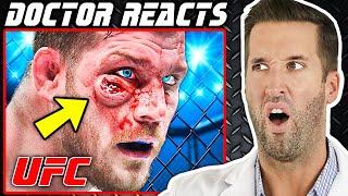 ER Doctor REACTS to Worst MMA Injuries in UFC History