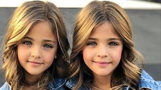 В 2017 году их называли самыми красивыми близняшками! Посмотрите какие они сейчас!