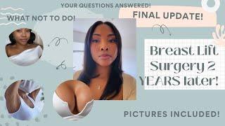 BREAST LIFT (WITHOUT IMPLANTS) UPDATE! NEW PHOTO, TIPS, WARNINGS & YOUR QUESTIONS ANSWERED!