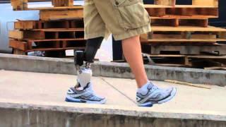 PowerFoot BiOM by iWalk