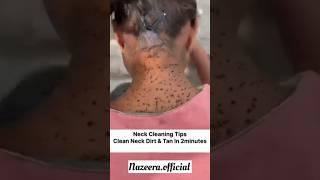 Neck Cleaning Tips | Get Rid Of Dark & Dirty Neck/Clean Neck Dirt & Suntan #skincare #video #shorts