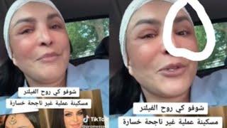 مسكينة ربيكا عملية غير ناحجة خسارة ⁉️