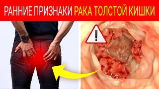 Внимание! 11 ТИХИХ СИМПТОМОВ РАКА ТОЛСТОЙ КИШКИ (КОТОРЫЕ ВЫ ИГНОРИРУЕТЕ)