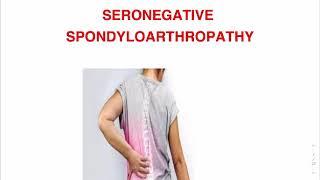 Seronegative Spondyloarthropathy, Ankylosing Spondylitis #AS #Spondyloarthopathy #Rheumatology