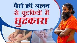 पैरों की जलन से पाएं चुटकियों में छुटकारा | Swami Ramdev