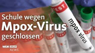 Mpox-Virus in NRW: Schule in Rösrath geschlossen | WDR Aktuelle Stunde