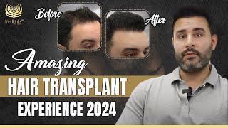 Confidence Revolution | Amazing Hair Transplant Experience | MedLinks