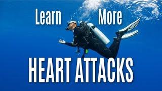 Heart attacks and pace makers! Can I still dive?