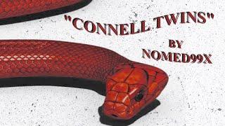 Nomed99x - Connell Twins (Official Lyric Video)