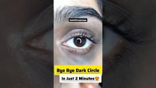 Remove Dark Circles Natural At Home/Dark Circle Remove️/#darkcircles #diy #shorts #ytshorts