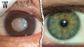 Signs of EYE COLOR ANCESTRY You Shouldn't Ignore