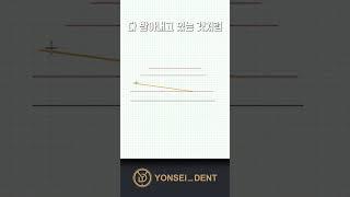 [코인투자자 필수 개념!] 거래량 - CVD를 볼 때 실수하면 안되는 개념은? #cvd  #비트코인 #코인방법 #코인매매 #알트코인 #코인전략 #코인투자 #거래량