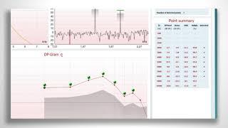 New IA OAE Suite - Interacoustics