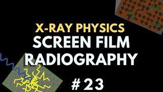 Screen Film Radiography | X-ray Physics | Radiology Physics Course #30