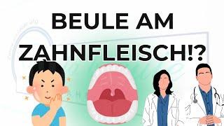 Beule am Zahnfleisch?!