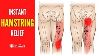 How to Fix Hamstring Pain FOR GOOD