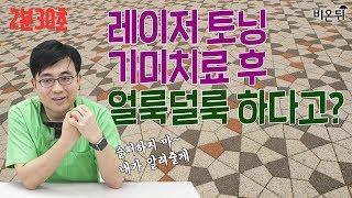 [2분30초] 기미치료 레이저 토닝 후 얼룩덜룩해져도 방법은 있다 - 오월의아침피부과 박준홍원장