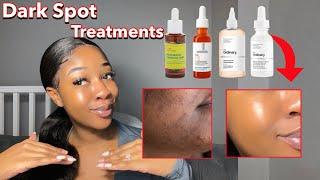 PRODUCTS THAT REMOVE DARK SPOTS AND DISCOLOURATION QUICKLY‼️