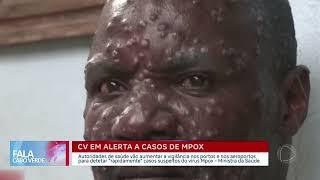 Cabo Verde em alerta a caso do vírus Mpox | Fala Cabo Verde