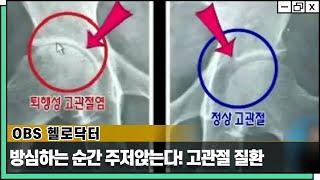 방심하는 순간 주저앉는다! 건강한 노년을 위한 고관절 질환의 모든 것  [OBS 헬로닥터 방송 - 웰튼병원 송상호 병원장]