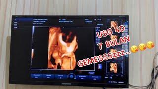 USG 4 DIMENSI 7 BULAN