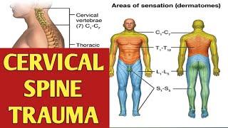 Cervical Spinal Injury - Cervical Spine Trauma - QUADRIPLEGIA AND ITS MANAGEMENT