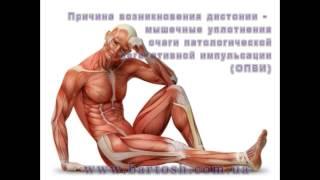 Вегето сосудистая дистония