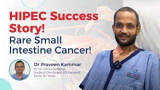 Triumph Over Cancer: Rare Small Intestine Cancer | Successful HIPEC Surgery  | Dr Praveen Kammar