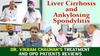 Liver Cirrhosis and Ankylosing Spondylitis - Dr. Vikram Chauhan's Treatment and OPD Patients Reviews