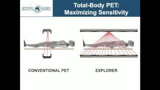 Simon Cherry: EXPLORER -- Changing the Molecular Imaging Paradigm with Total-Body PET/CT