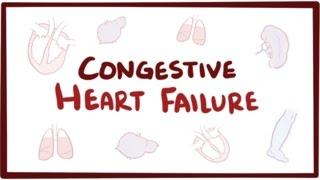 Congestive heart failure (CHF) - systolic, diastolic, left side, right side, & symptoms