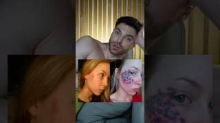 ФОТООМОЛОЖЕНИЕ- не омолаживает, но отлично решает многие эстетические проблемы.