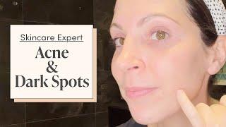 A Dermatologist & Acne Specialist's Nighttime Skincare Routine | Skincare Expert