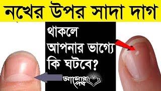 নখে সাদা দাগ থাকলে আপনার ভাগ্যে কি ঘটবে? সকলের জানা জরুরী!