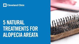 Natural Treatment Options for Alopecia